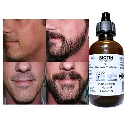 aceite de cacahuate para nutrición del cabello