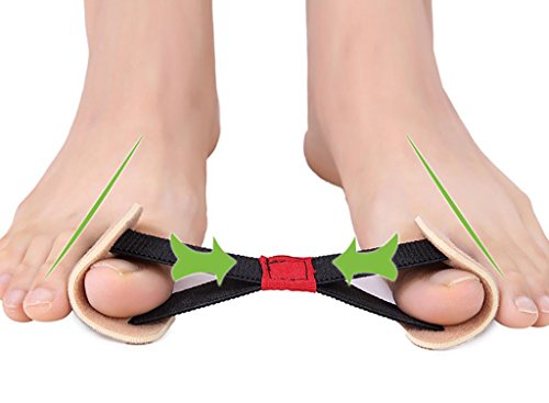 alineador de hallux valgus para pies sanos
