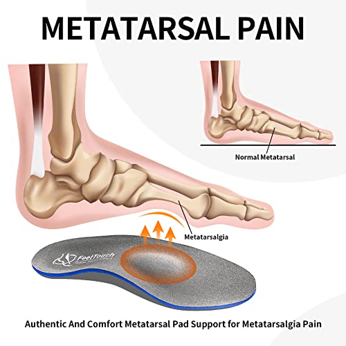 alivio para neuroma de Morton