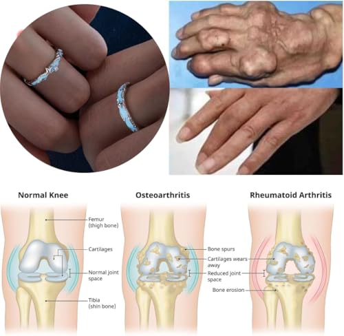 anillo de titanio para hombres y mujeres