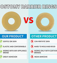 anillos de ostomía fáciles de usar