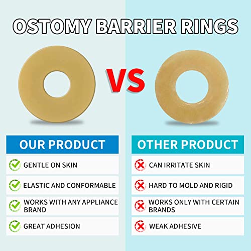 anillos de ostomía fáciles de usar