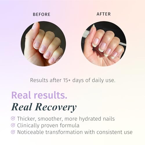 Base y top coat para uñas fuertes