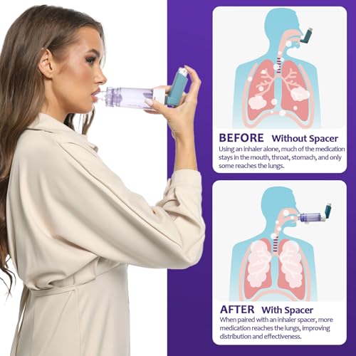 cámara antiestática espaciador inhalador