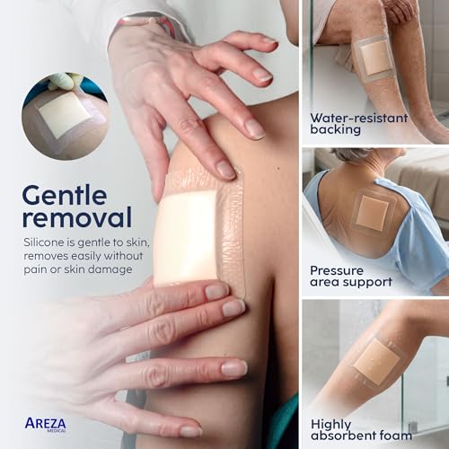 Capa absorbente para heridas