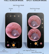 compatible con iPhone y Android