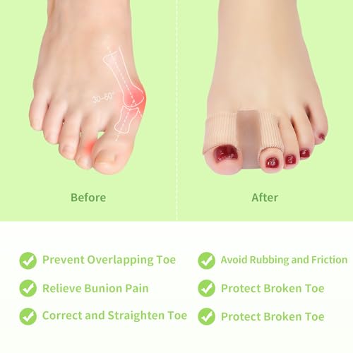 corrector de juanetes para hombres y mujeres