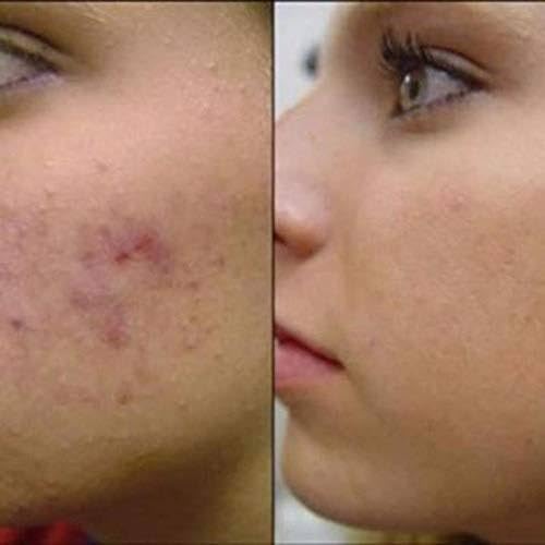 crema MEBO para salud y belleza