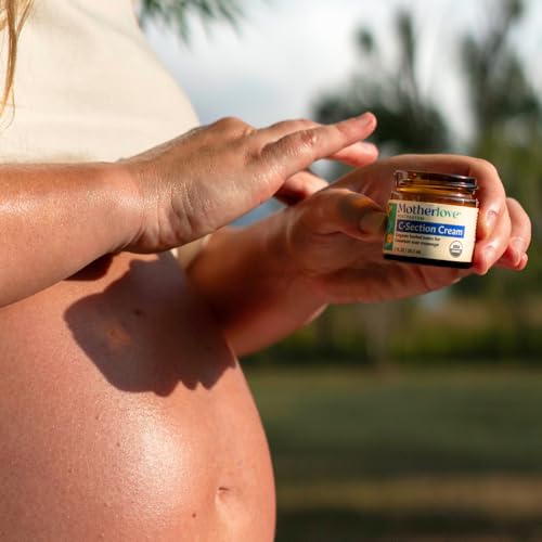 crema Motherlove para cicatrices