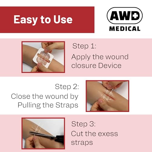 Cuidado de heridas en casa