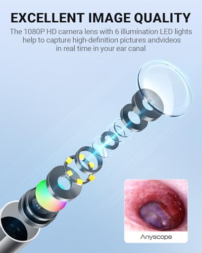 diagnóstico médico fácil con otoscopio