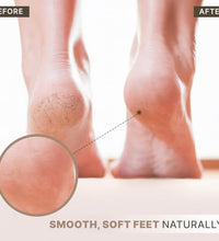 Exfoliante efectivo para piel agrietada