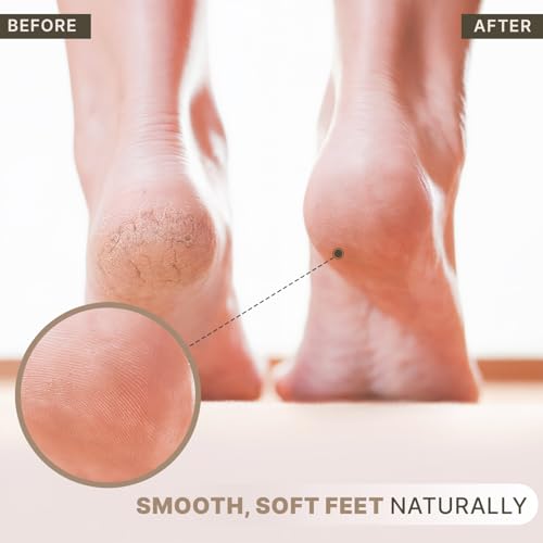 Exfoliante efectivo para piel agrietada