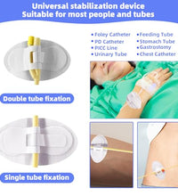 Fijación segura para tubos médicos