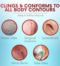 Gasas no adherentes para cuidado de heridas