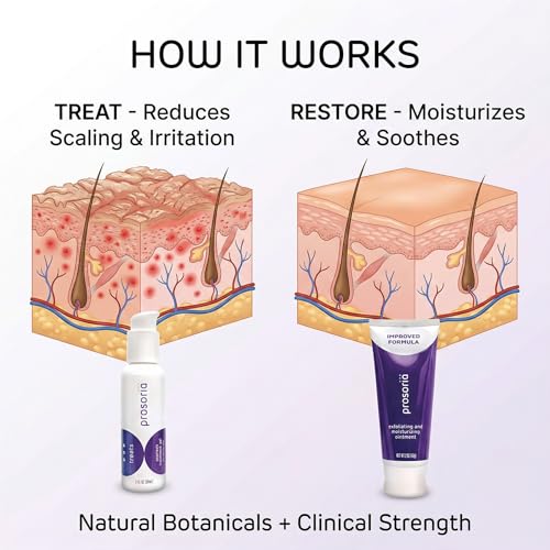 gel y ungüento para psoriasis