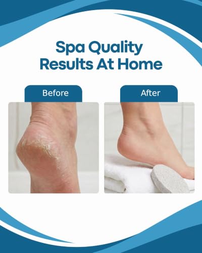 herramienta ideal para pedicura