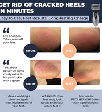 herramienta para pedicura en casa