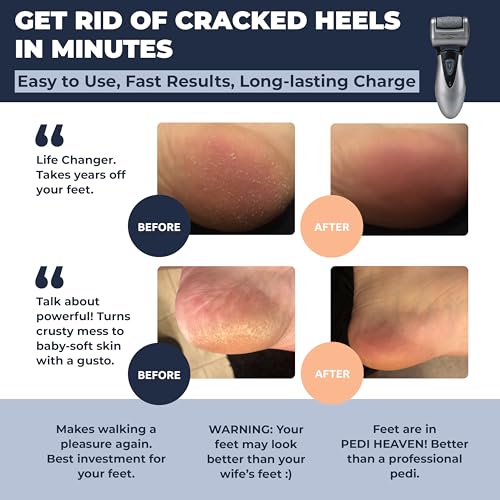 herramienta para pedicura en casa