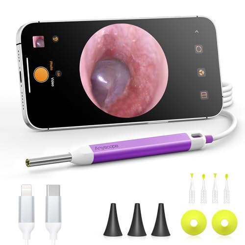 otoscopio digital para revisión de oídos