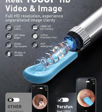 otoscopio para limpieza de oídos