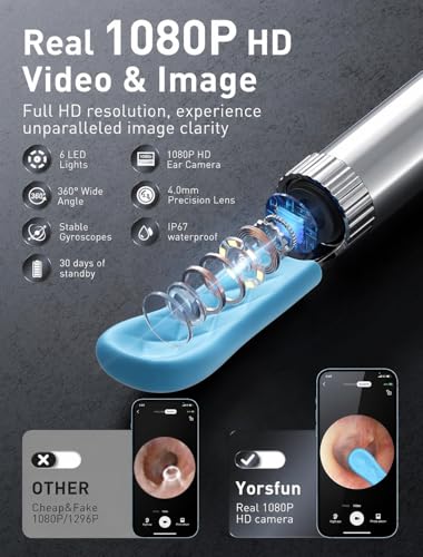 otoscopio para limpieza de oídos