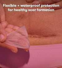 Parches reutilizables para C-Section