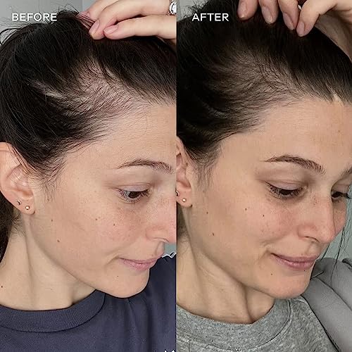 péptidos de colágeno para cabello saludable