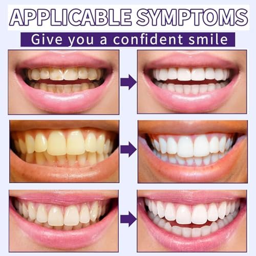 2 Piezas de Polvo Mineral para Dientes, Efecto Significativo en Dientes y Encías, Sin Sensibilidad - Refresca el Aliento - imagen 4