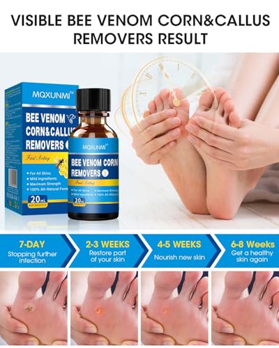 MQXUNMI Removedor de Verrugas con Veneno de Abeja, 20ML, Eliminador Rápido de Callos y Verrugas para Pies, Cuidado Seguro con Almohadillas para Callos - imagen 4