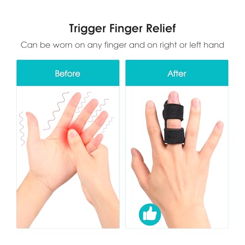 Férula para Dedos Cozyhealth (Paquete de 2), Enderezador Universal para Dedos, Soporte para Artritis y Alivio de Esguince para Dedos Medio, Índice, - imagen 4