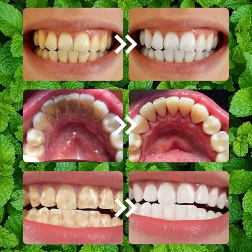 Polvo Mineral para Restauración Dental 2PCS, Blanqueador de Dientes, Refuerza Dientes y Encías, 50g, Aliento Fresco para Uso Diario - imagen 5