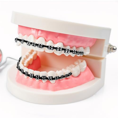 Kit de Brackets Falsos para Dientes, Clip Temporal con Alambres, Ideal para Ortodoncistas y Estudiantes de Odontología - Color Negro - imagen 3