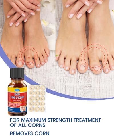MYMULIKE Removedor de Maíz Líquido, Acción Rápida y Segura para Dedos, Extra Fuerte para Niños y Adultos, 15ml con 15 Almohadillas y 10 Aplicadores - imagen 2