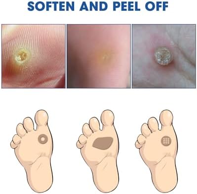 MYMULIKE Removedor de Maíz Líquido, Acción Rápida y Segura para Dedos, Extra Fuerte para Niños y Adultos, 15ml con 15 Almohadillas y 10 Aplicadores - imagen 5