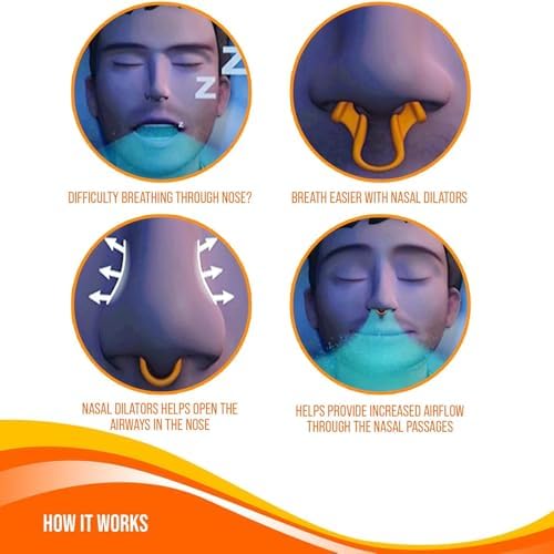 Dilatadores Nasales para Ronquidos - Antirronquido - Versión Mejorada - Ayudas para la Respiración - 4 Paquetes, 2 Pequeños y 2 Medianos - Mobi Lock - imagen 2