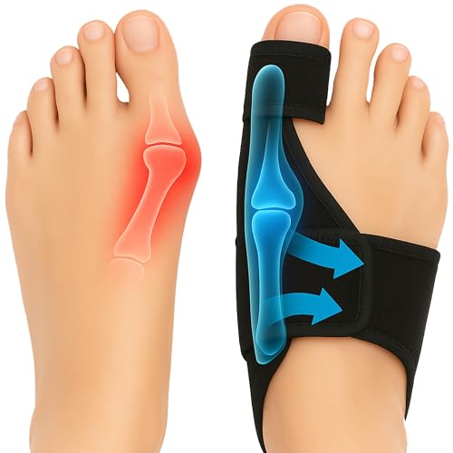 Corrector de Juanetes para Mujeres y Hombres (2 Piezas) Enderezador de Dedo en Garra, Alivio para Juanetes, Separador de Dedo Grande, Soporte - imagen 1