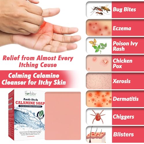 Jabón Natural para Alivio Instantáneo de Picazón - Jabón Calmante de Calamina para Piel Irritada, Picaduras de Insectos, Eccema y Más - imagen 2