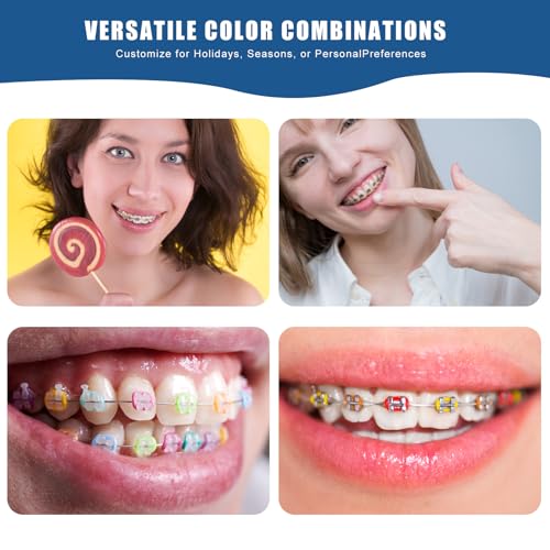 Juego de Herramientas para Brackets TTKBHHQ - 2080 Ligaduras Ortodónticas Multicolor y Accesorios DIY - imagen 3