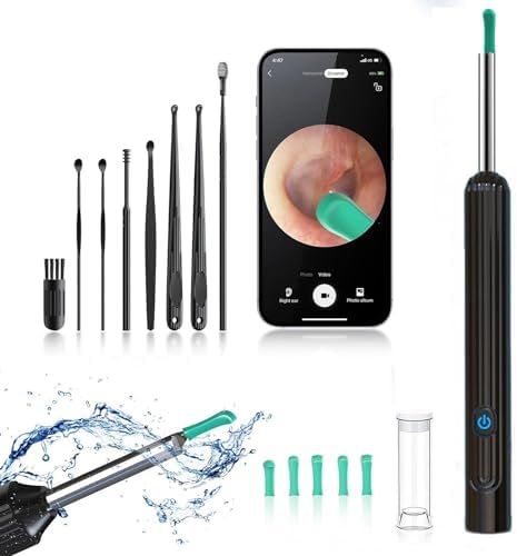 Herramienta de Eliminación de Cerumen OKUBOX, Limpiador de Oídos con Cámara y Luz, Kit Inteligente de Limpieza de Cerumen a Prueba de Agua con - imagen 1