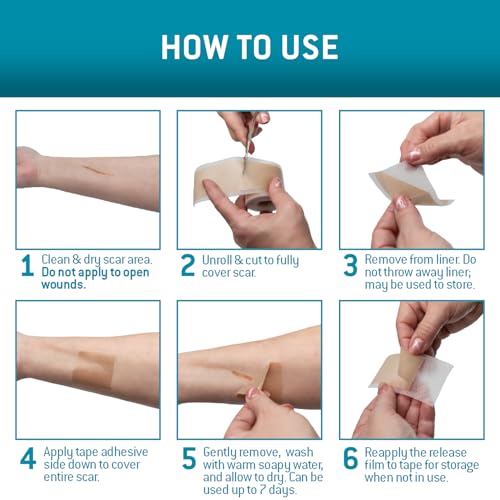 Cinta de Silicona Care Science para Cicatrices 1.6 x 120in 1ct | Cinta para Cicatrices Quirúrgicas, Keloides, Estrías, C-Section, Quemaduras, - imagen 7