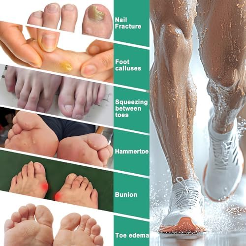 Protectores de Dedos Aheroi, 50 Piezas de Mangas de Silicón para Mujeres y Hombres, Alivio para Dedo Meñique, Cubiertas de Gel para Juanetes, - imagen 4