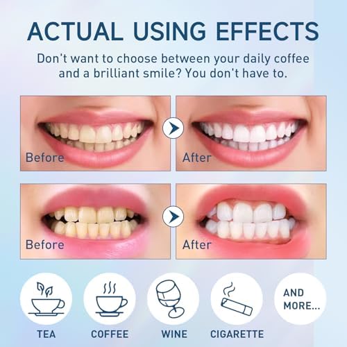 Polvo Blanqueador de Dientes Remineralizante Sabor Menta 50g - Polvo Instantáneo para Eliminar Manchas y Blanquear Dientes - imagen 3