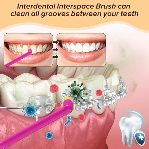 Cepillo Dental B Rush® Pequeño con Cabeza Ortodóntica - Cepillo de Punta Única para Brackets, Pack de 5 para Limpieza Detallada - imagen 4