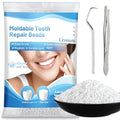 Perlas de Reparación Dental de 10.9oz - Kit de Reemplazo de Dientes para Restauración Temporal de Dientes Perdidos y Rotos, Perlas Térmicas para - imagen 1