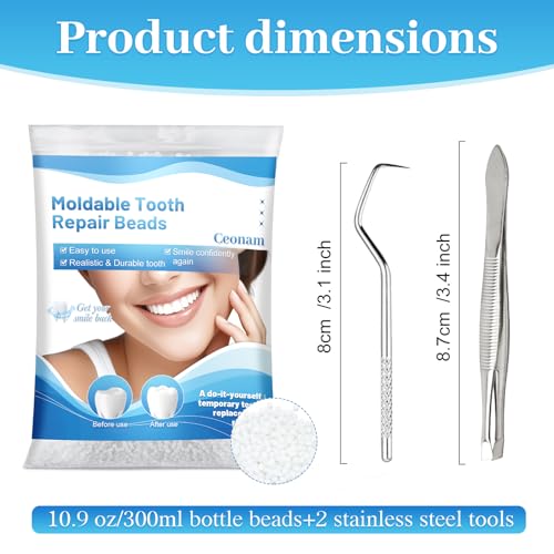 Perlas de Reparación Dental de 10.9oz - Kit de Reemplazo de Dientes para Restauración Temporal de Dientes Perdidos y Rotos, Perlas Térmicas para - imagen 2
