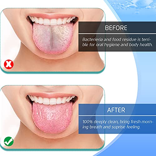Juego de 4 Raspadores de Lengua de Acero Inoxidable, Limpiadores de Lengua Reutilizables, Herramientas de Higiene Oral Saludable, Elimina el Mal - imagen 4