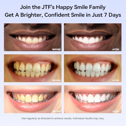 Kit de Blanqueamiento Dental JTF: 35% Peróxido de Carbamida, Elimina Manchas de Café, Vino y Tabaco, Seguro para Dientes Sensibles, 5 Lápices - imagen 3