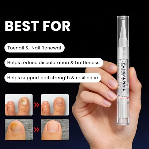Tratamiento para Hongos en Uñas Extra Fuerte, Lápiz para Hongos en Uñas y Dedos con 25% Ácido Undecilénico y 1% Tolnaftato para Mejorar Uñas - imagen 3