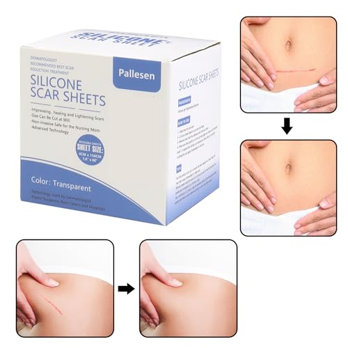 Hojas de Silicona para Cicatrices Pallesen, Cinta de Silicona 1.6”X 60”, Ideal para Cicatrices Quirúrgicas, C-Section, Abdominoplastia, Acné y - imagen 5